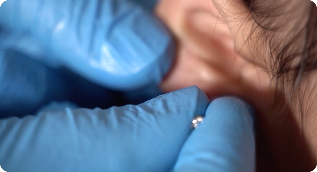 Traditional & Clinical Piercing